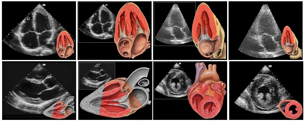 is 2d echo safe, transthoracic echocaridogram