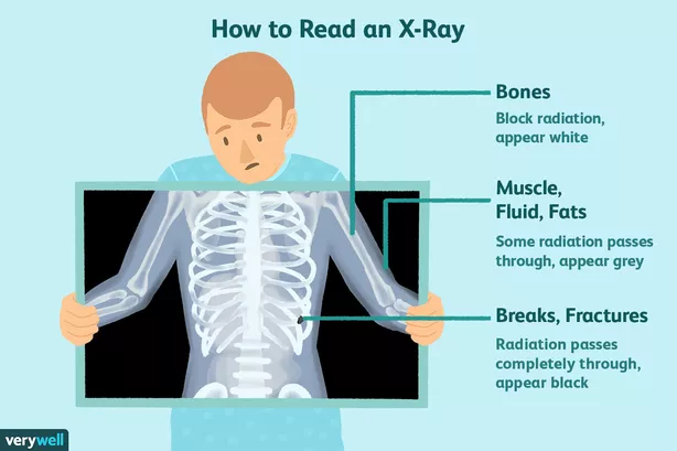 is x-ray or ct scan better, what is diagnostic process?