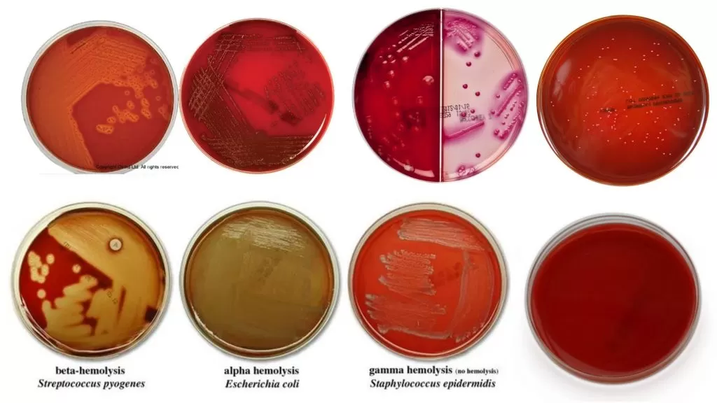 what is diagnostic process? , microbiological Culture