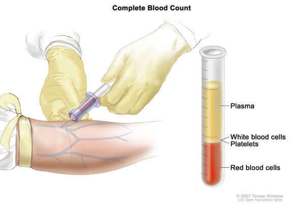 how blood test is done , complete blood Count