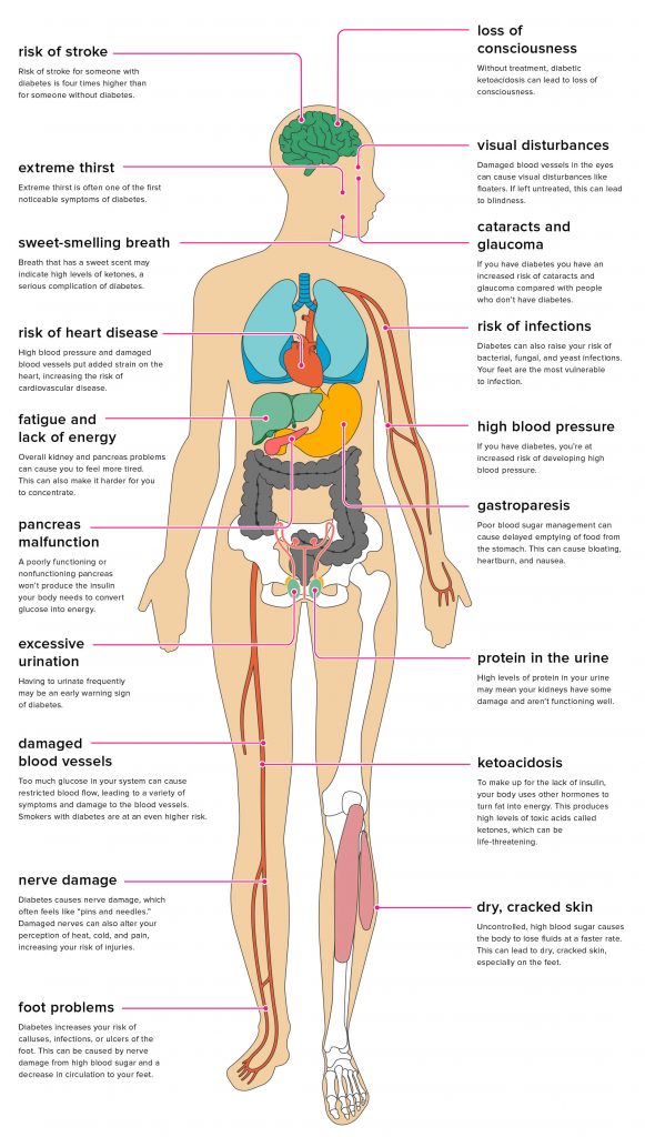 Does A Full Blood Count Detect Diabetes