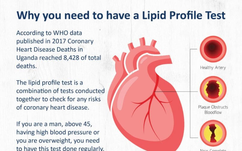 where blood test is done, Lipid profile