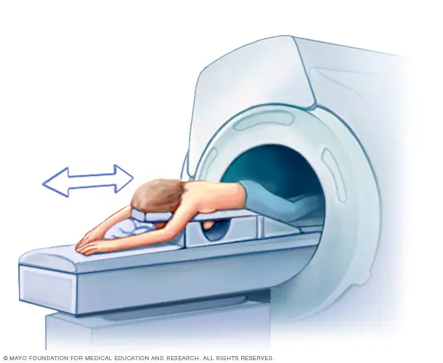 What-should-you-not-do-before-an-MRI, Breast-MRI
